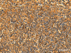 Immunohistochemistry of paraffin-embedded Human tonsil tissue using HS1BP3 Polyclonal Antibody at dilution of 1:50 (×200)