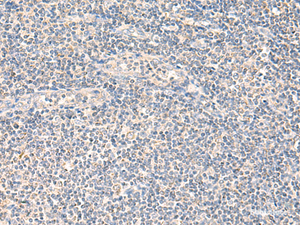 Immunohistochemistry of paraffin-embedded Human tonsil tissue using NEGR1 Polyclonal Antibody at dilution of 1:90 (×200)