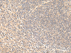 Immunohistochemistry of paraffin-embedded Human tonsil tissue using SULT4A1 Polyclonal Antibody at dilution of 1:65 (×200)