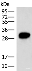 Western blot analysis of HepG2 cell lysate using HCCS Polyclonal Antibody at dilution of 1:4000