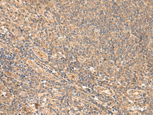 Immunohistochemistry of paraffin-embedded Human tonsil tissue using MEST Polyclonal Antibody at dilution of 1:65 (×200)
