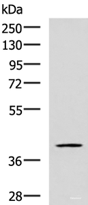 Western blot analysis of TM4 cell lysate using RAB3IL1 Polyclonal Antibody at dilution of 1:600