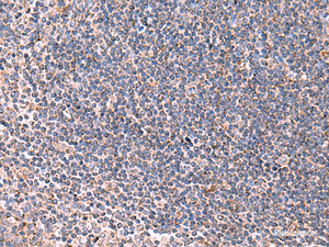 Immunohistochemistry of paraffin-embedded Human tonsil tissue using LIPA Polyclonal Antibody at dilution of 1:85 (×200)