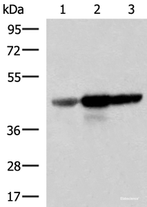 Western blot analysis of Human fetal brain tissue HepG2 and HT29 cell lysates using FDFT1 Polyclonal Antibody at dilution of 1:1000