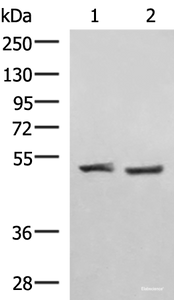 Western blot analysis of Human cerebella tissue K562 cell lysates using RRP8 Polyclonal Antibody at dilution of 1:1000