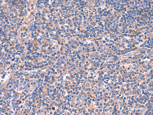 Immunohistochemistry of paraffin-embedded Human tonsil tissue using MPP1 Polyclonal Antibody at dilution of 1:50 (×200)