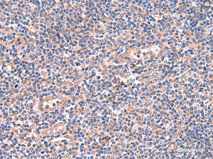 Immunohistochemistry of paraffin-embedded Human tonsil tissue using OSBPL2 Polyclonal Antibody at dilution of 1:55 (×200)