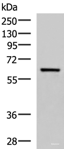 Western blot analysis of Human fetal brain tissue lysate using SARS Polyclonal Antibody at dilution of 1:850