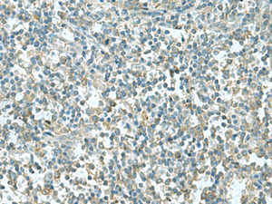Immunohistochemistry of paraffin-embedded Human tonsil tissue using CCT5 Polyclonal Antibody at dilution of 1:55 (×200)