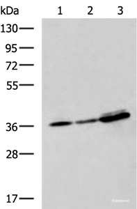 Western blot analysis of A549 A172 and HepG2 cell lysates using EEF1D Polyclonal Antibody at dilution of 1:950