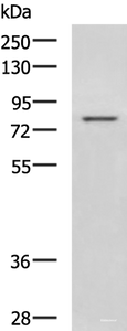 Western blot analysis of Rat liver tissue lysate using DHX58 Polyclonal Antibody at dilution of 1:800