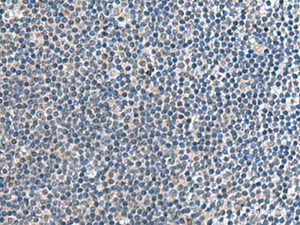 Immunohistochemistry of paraffin-embedded Human tonsil tissue using CNTN4 Polyclonal Antibody at dilution of 1:65 (×200)