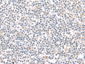 Immunohistochemistry of paraffin-embedded Human tonsil tissue using IFI27 Polyclonal Antibody at dilution of 1:100 (×200)