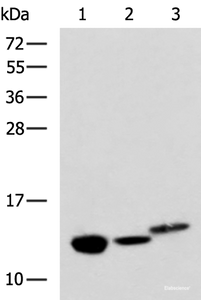 Western blot analysis of Rat kidney tissue Mouse liver tissue and Human fetal liver tissue lysates using RIDA Polyclonal Antibody at dilution of 1:600