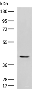 Western blot analysis of Mouse heart tissue lysate using STK32A Polyclonal Antibody at dilution of 1:1000