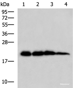 Western blot analysis of Rat brain tissue Hela HepG2 and A172 cell lysates using HPCAL1 Polyclonal Antibody at dilution of 1:1000