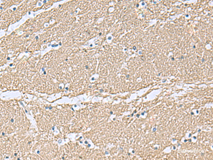 Immunohistochemistry of paraffin-embedded Human brain tissue using TAGLN3 Polyclonal Antibody at dilution of 1:70 (×200)