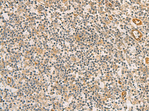 Immunohistochemistry of paraffin-embedded Human tonsil tissue using RAB13 Polyclonal Antibody at dilution of 1:50 (×200)