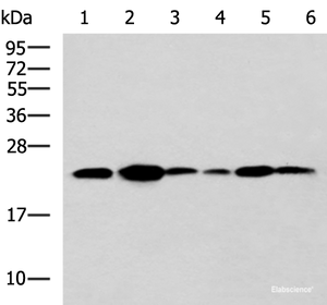Western blot analysis of NIH/3T3 cell Mouse Pancreas tissue Rat lung tissue Mouse liver tissue Hela Raji cell lysates using TMED10 Polyclonal Antibody at dilution of 1:900