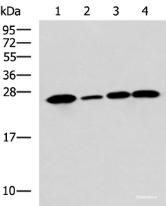 Western blot analysis of Human cerebrum tissue A172 cell Mouse brain tissue Rat brain tissue lysates using UCHL1 Polyclonal Antibody at dilution of 1:900