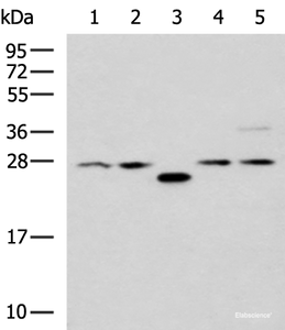 Western blot analysis of 293T cell lysates using PSMA6 Polyclonal Antibody at dilution of 1:1000