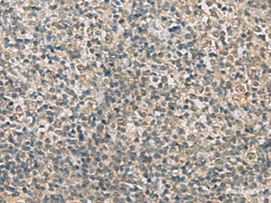 Immunohistochemistry of paraffin-embedded Human tonsil tissue using RAB3IP Polyclonal Antibody at dilution of 1:60 (×200)