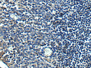 Immunohistochemistry of paraffin-embedded Human tonsil tissue using PRRT2 Polyclonal Antibody at dilution of 1:40 (×200)