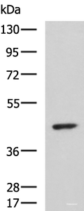 Western blot analysis of Hela cell lysate using ARPC1B Polyclonal Antibody at dilution of 1:1000