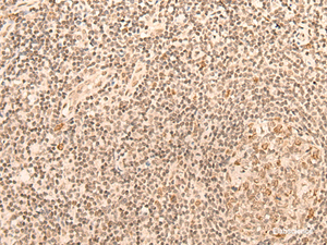 Immunohistochemistry of paraffin-embedded Human tonsil tissue using CCNE1 Polyclonal Antibody at dilution of 1:25 (×200)
