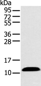 Western blot analysis of Human plasma solution using PPBP Polyclonal Antibody at dilution of 1:500