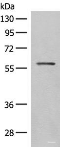 Western blot analysis of Mouse eye tissue lysate using SLC5A1 Polyclonal Antibody at dilution of 1:500