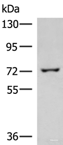 Western blot analysis of 293T cell lysate using GLS Polyclonal Antibody at dilution of 1:850