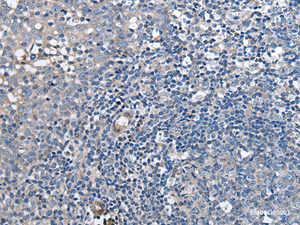 Immunohistochemistry of paraffin-embedded Human tonsil tissue using F3 Polyclonal Antibody at dilution of 1:60 (×200)