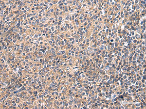 Immunohistochemistry of paraffin-embedded Human tonsil tissue using UBTD1 Polyclonal Antibody at dilution of 1:25 (×200)