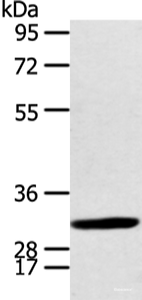 Western blot analysis of Human fetal brian tissue using CALB2 Polyclonal Antibody at dilution of 1:400