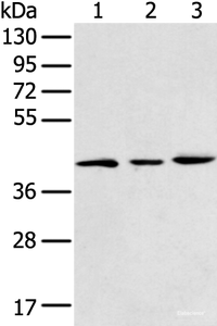 Western blot analysis of 293T K562 and Raji cell using DCX Polyclonal Antibody at dilution of 1:400