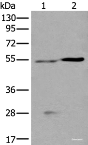 Western blot analysis of Human left kidney tissue and Human fetal liver tissue lysates using DDC Polyclonal Antibody at dilution of 1:400