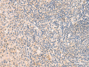 Immunohistochemistry of paraffin-embedded Human tonsil tissue using GRM2 Polyclonal Antibody at dilution of 1:50 (×200)