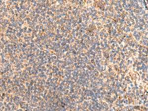 Immunohistochemistry of paraffin-embedded Human tonsil tissue using ABHD2 Polyclonal Antibody at dilution of 1:40 (×200)