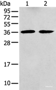 Western blot analysis of Mouse brain tissue and Human fetal brain tissue using GNAI2 Polyclonal Antibody at dilution of 1:400