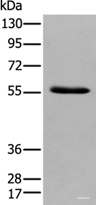 Western blot analysis of Human pancreas tissue using GPC4 Polyclonal Antibody at dilution of 1:500