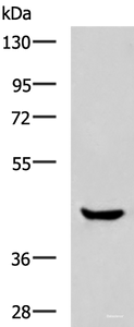 Western blot analysis of Human muscle tissue lysate using HOXA2 Polyclonal Antibody at dilution of 1:800