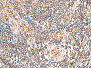 Immunohistochemistry of paraffin-embedded Human tonsil tissue using ARF5 Polyclonal Antibody at dilution of 1:40 (×200)