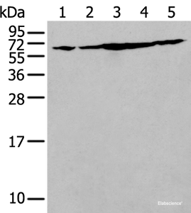 Western blot analysis of NIH/3T3 Hela Jurkat Hepg2 and A549 cell lysates using IRF5 Polyclonal Antibody at dilution of 1:250