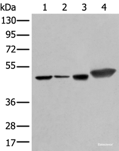 Western blot analysis of Hepg2 A431 Hela and A549 cell lysates using PLAG1 Polyclonal Antibody at dilution of 1:250