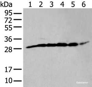 Western blot analysis of PC-3 cell mouse skeletal muscle tissue mouse brain tissue human heart tissue Hela and HEPG2 cell lysates using ETFB Polyclonal Antibody at dilution of 1:400