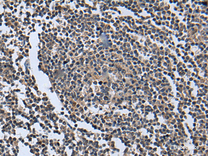 Immunohistochemistry of paraffin-embedded Human tonsil tissue using WNT9B Polyclonal Antibody at dilution of 1:85 (×200)