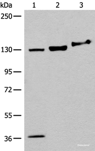 Western blot analysis of 293T cell Mouse brain tissue lysates using EPHA6 Polyclonal Antibody at dilution of 1:500