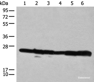 Western blot analysis of 293T cell lysates using RPL14 Polyclonal Antibody at dilution of 1:300