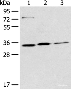 Western blot analysis of 293T Hela and A431 cell lysates using MORF4L2 Polyclonal Antibody at dilution of 1:500